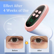 EMS Facial Lifting Muscle Stimulator