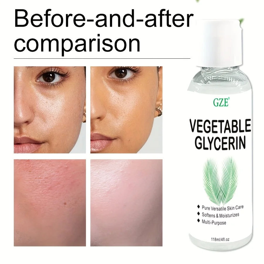 GZE 100% Pure Vegetable Glycerin Multi-Purpose Skin Care